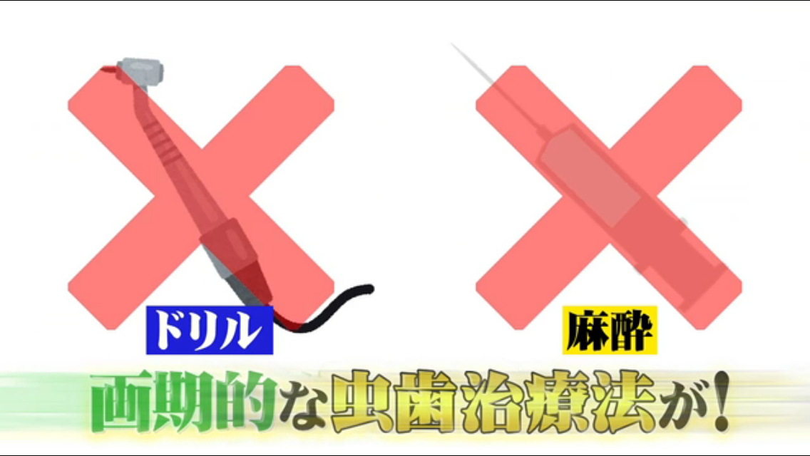 画期的な虫歯治療方が